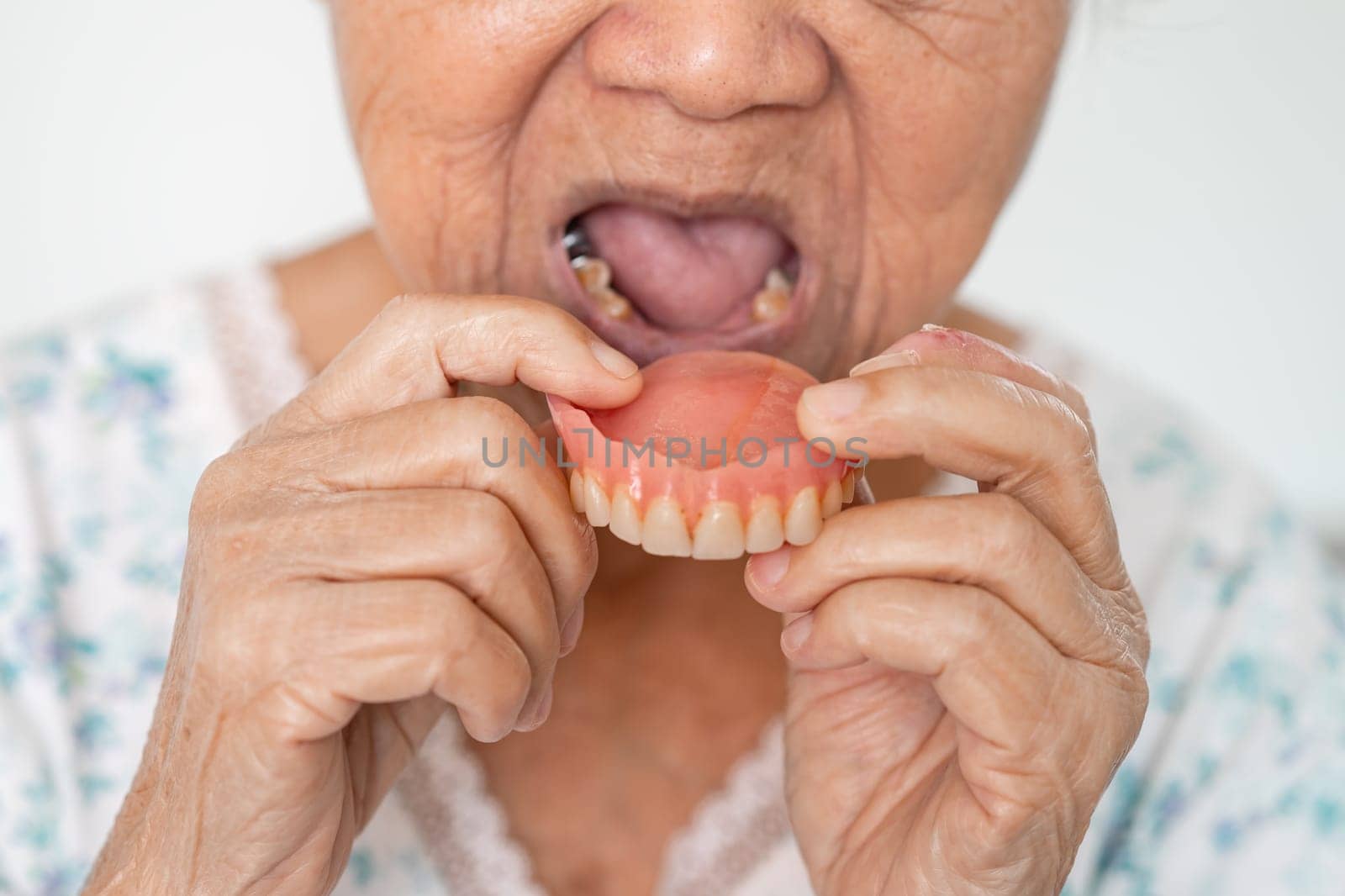 Asian elderly woman patient holding to use denture, healthy strong medical concept. by pamai