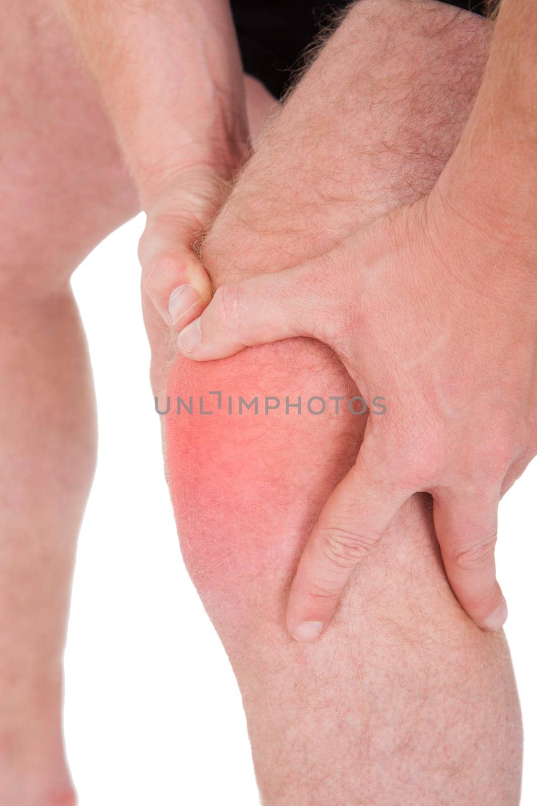 Man With Knee Pain On White Background