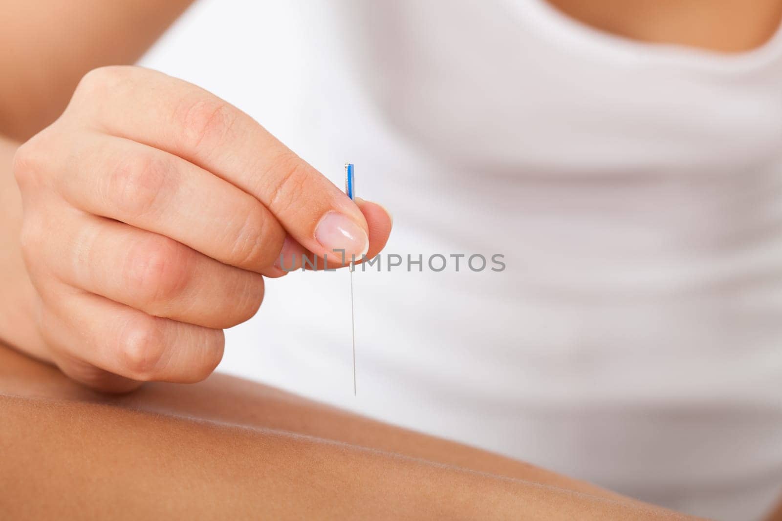 Close-up Of The Hand Stimulating Acupuncture Needle