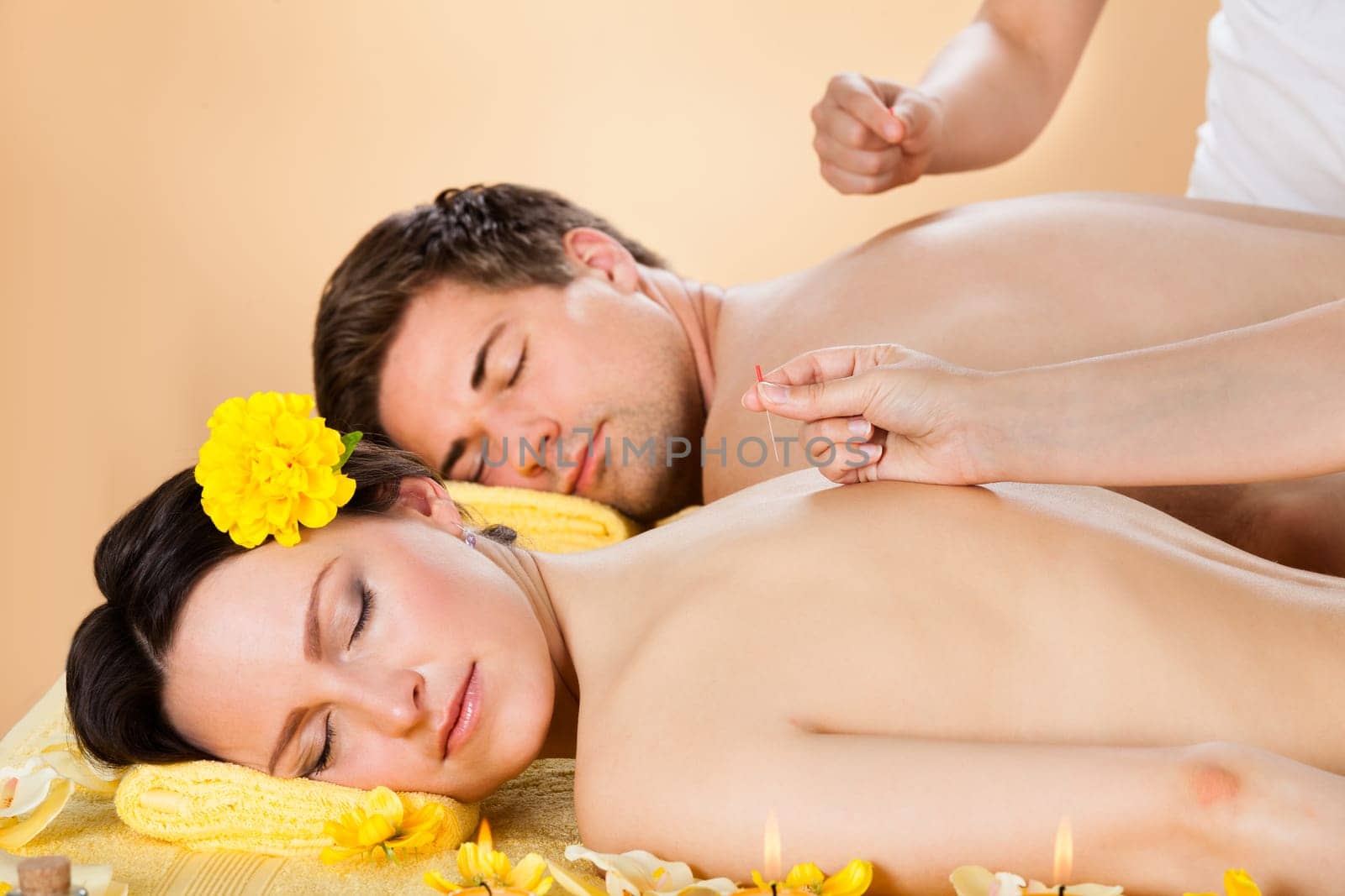 Relaxed young couple receiving acupuncture treatment at beauty spa