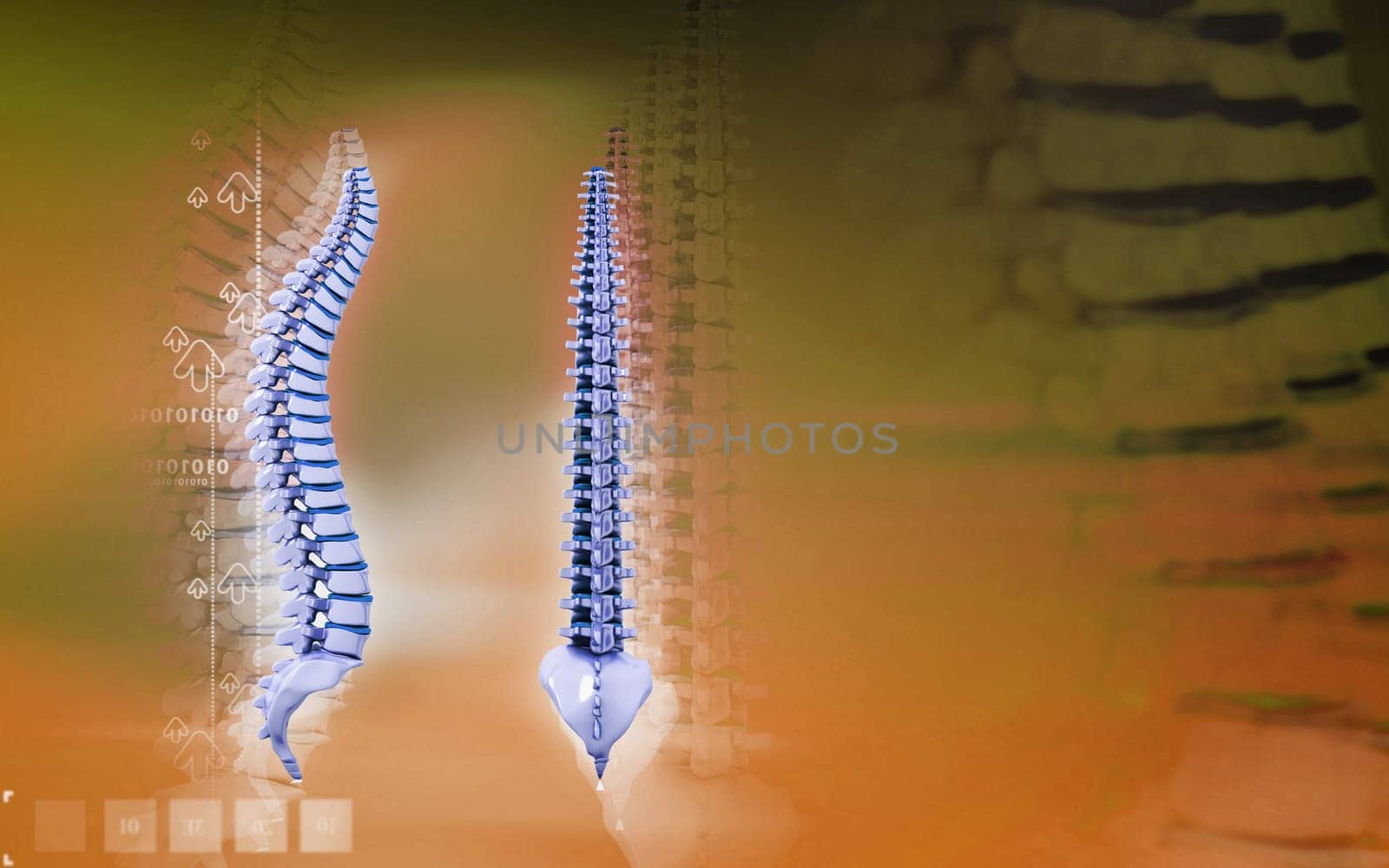 Back bone