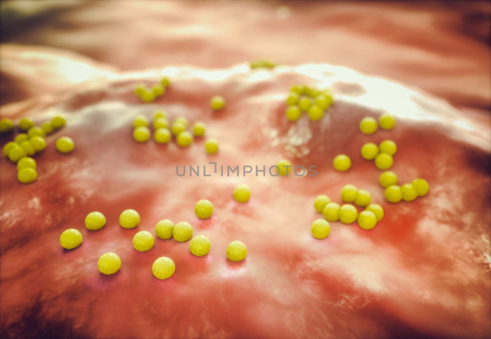 MRSA under the microscope in detailed view