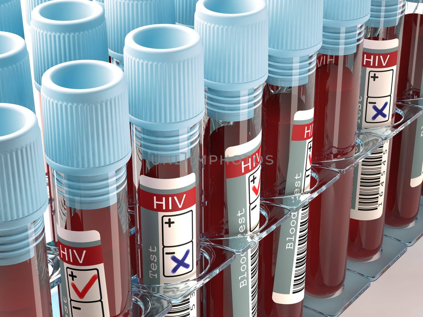 Image concept with the result of the HIV test.
