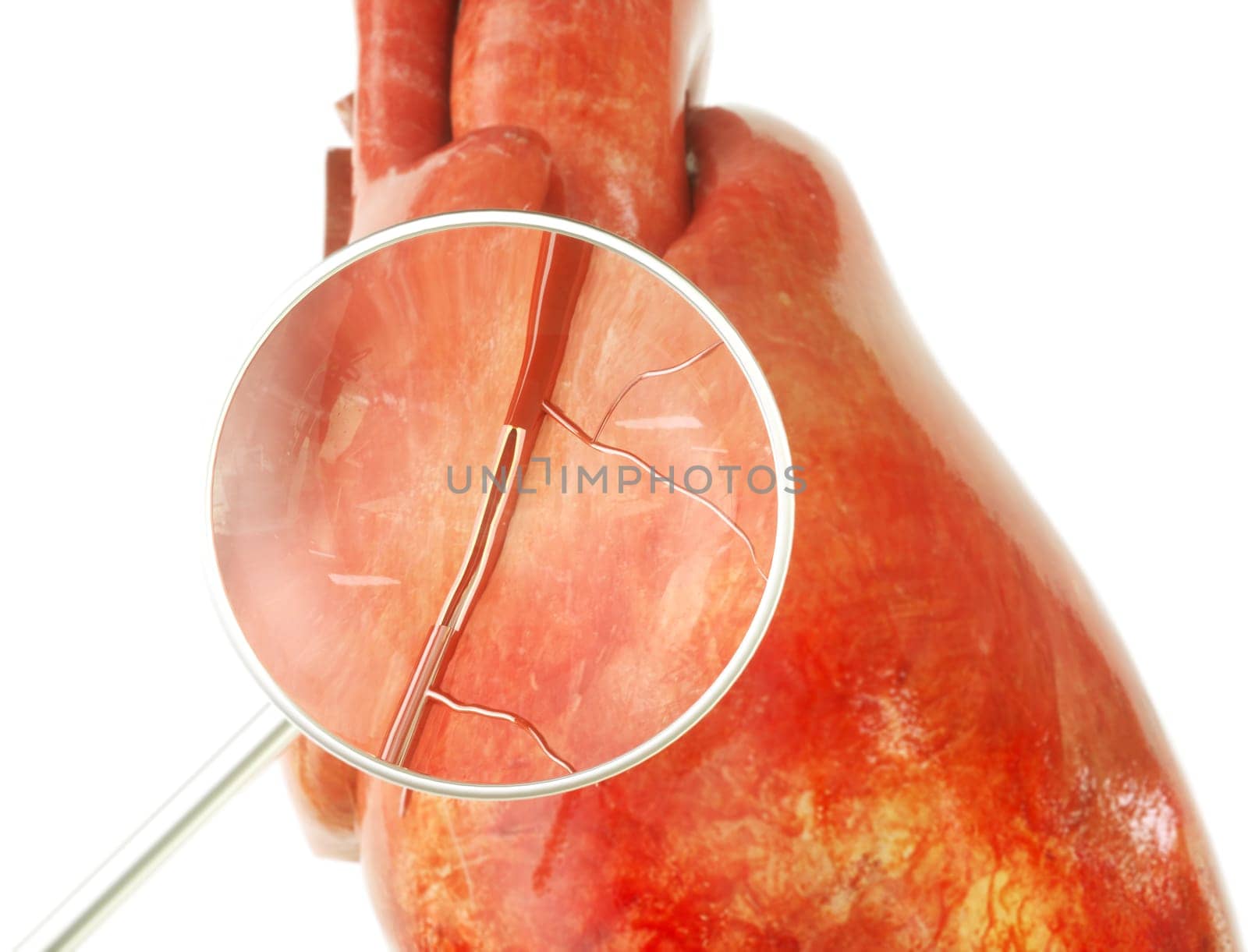 Healthy heart with visible coronary artery in cross section