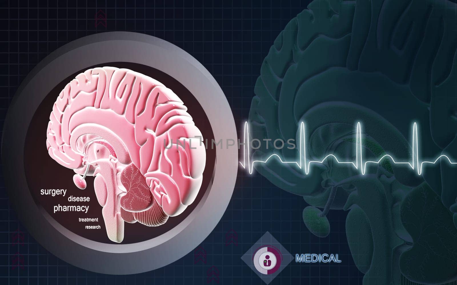 Digital illustration of brain in colour background