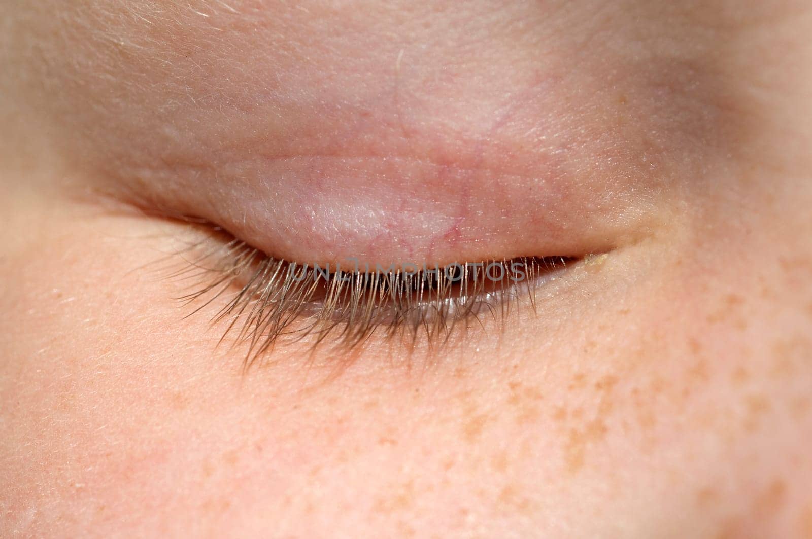 Eyelash,eye  Lid
