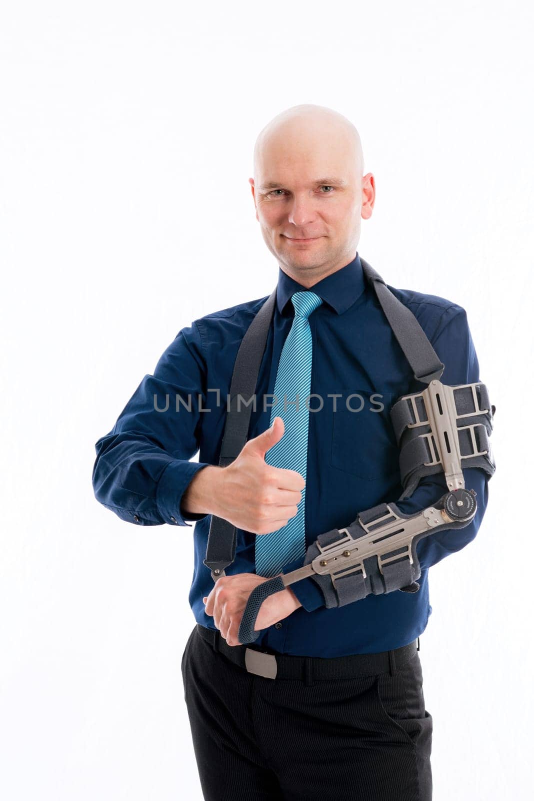 young bald business man with fractured arm and thumb up