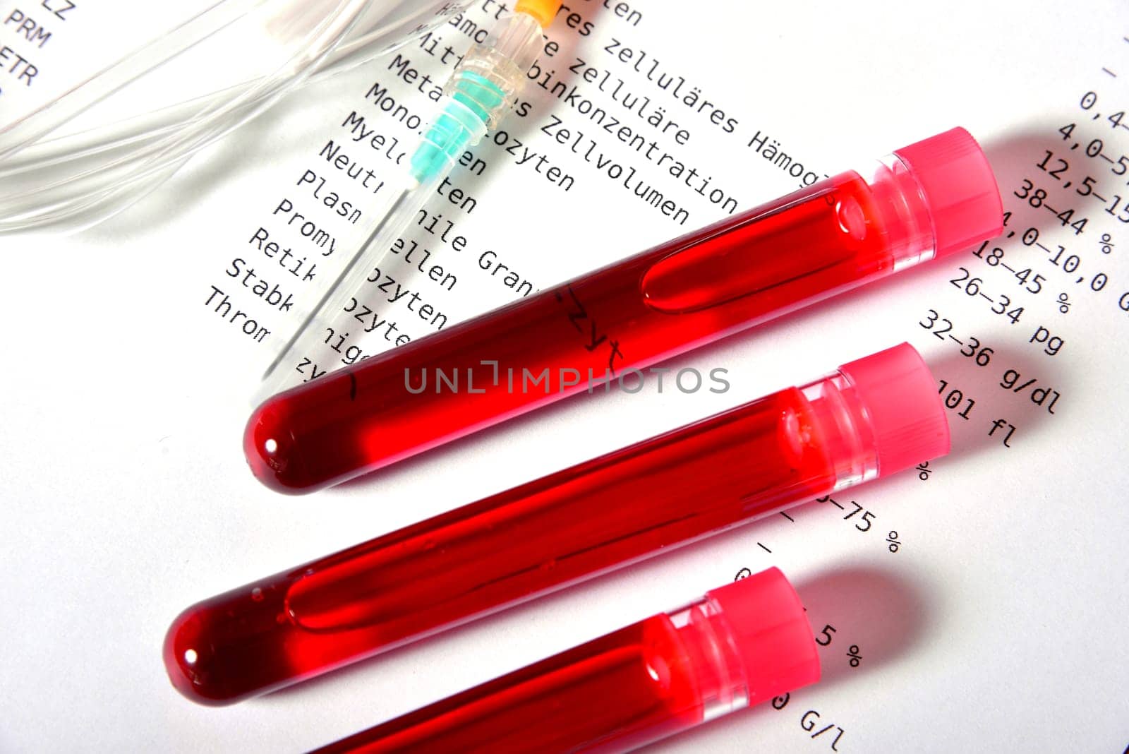Laboratory Blood Test Laboratory Medicine