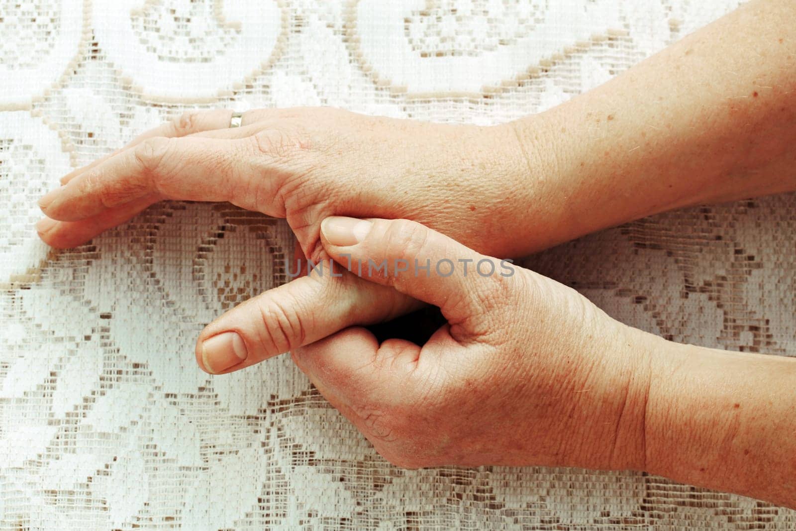 A woman has pain in her fingers,hands and joints