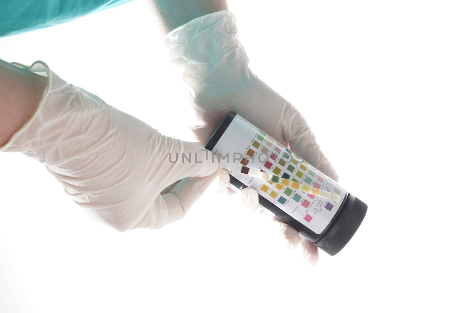 Urine test stripes examined by a nurse. Lab sample