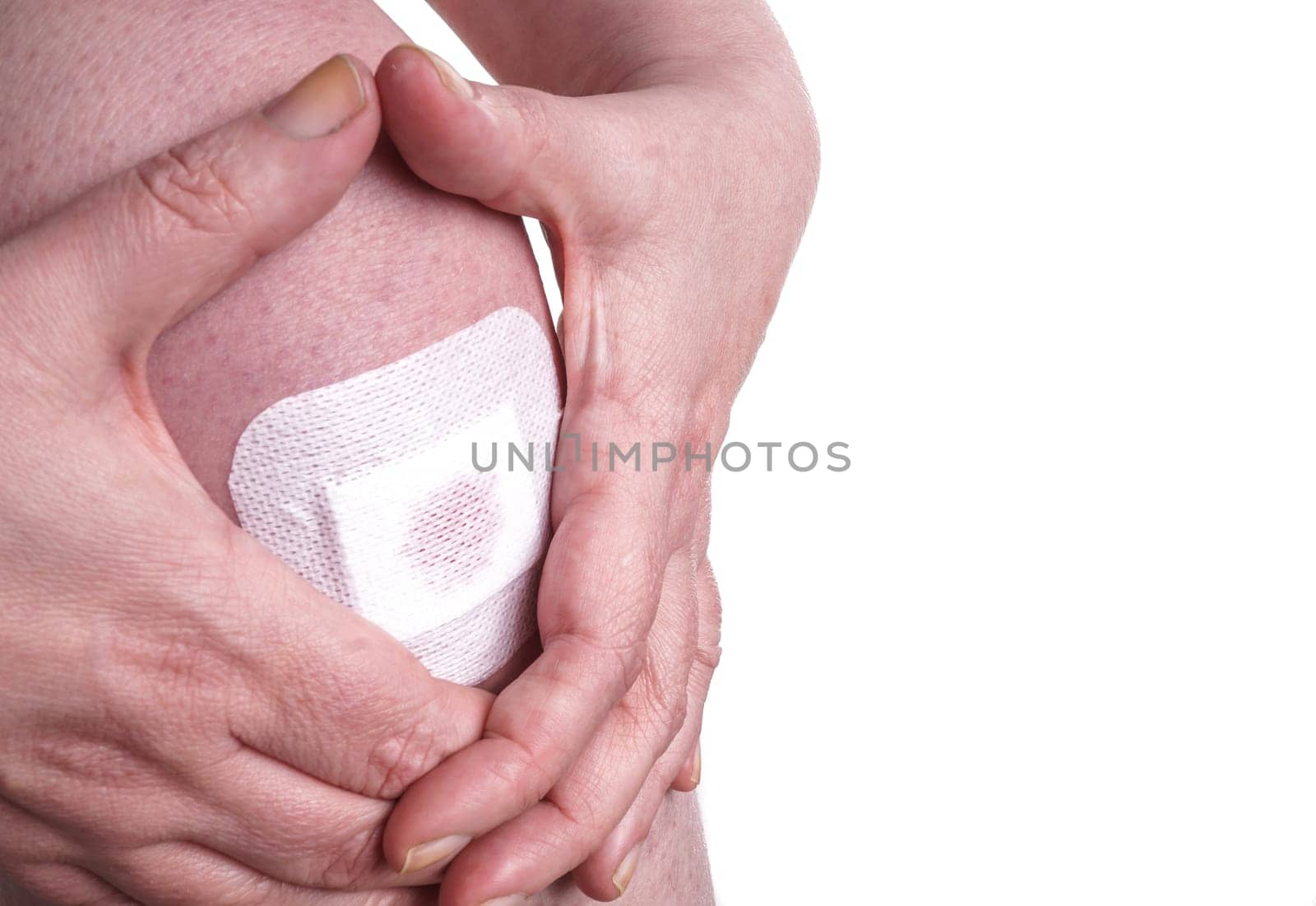 Women with wounds on her knees. The damage is treated with an adhesive bandage , so to prevent the blood from flowing. Isolated on white