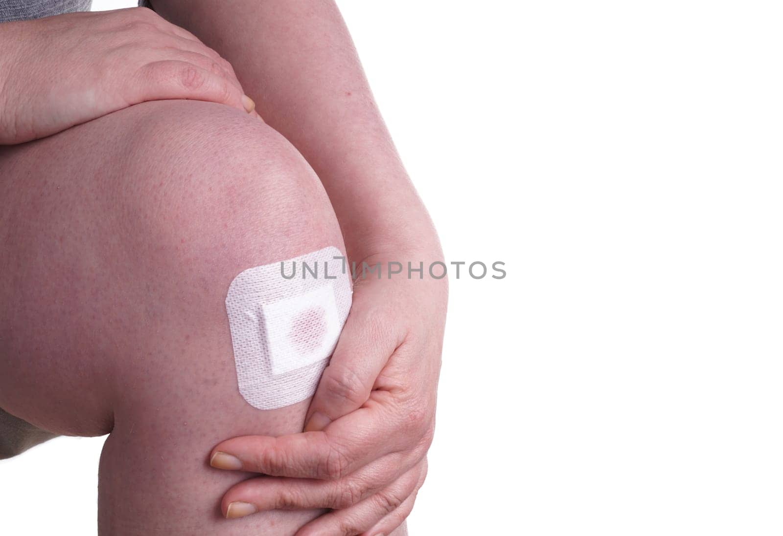 Women with wounds on her knees. The damage is treated with an adhesive bandage , so to prevent the blood from flowing. Isolated on white
