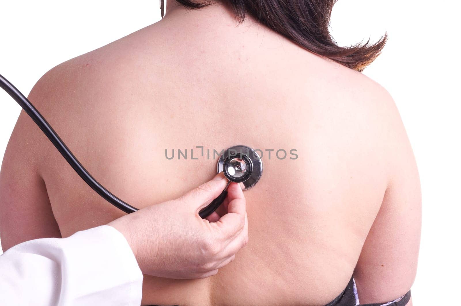 Young woman being investigated for pneumonia by her family doctor . Isolated on white. The picture shows her bare back , doctor's hand and stethoscope