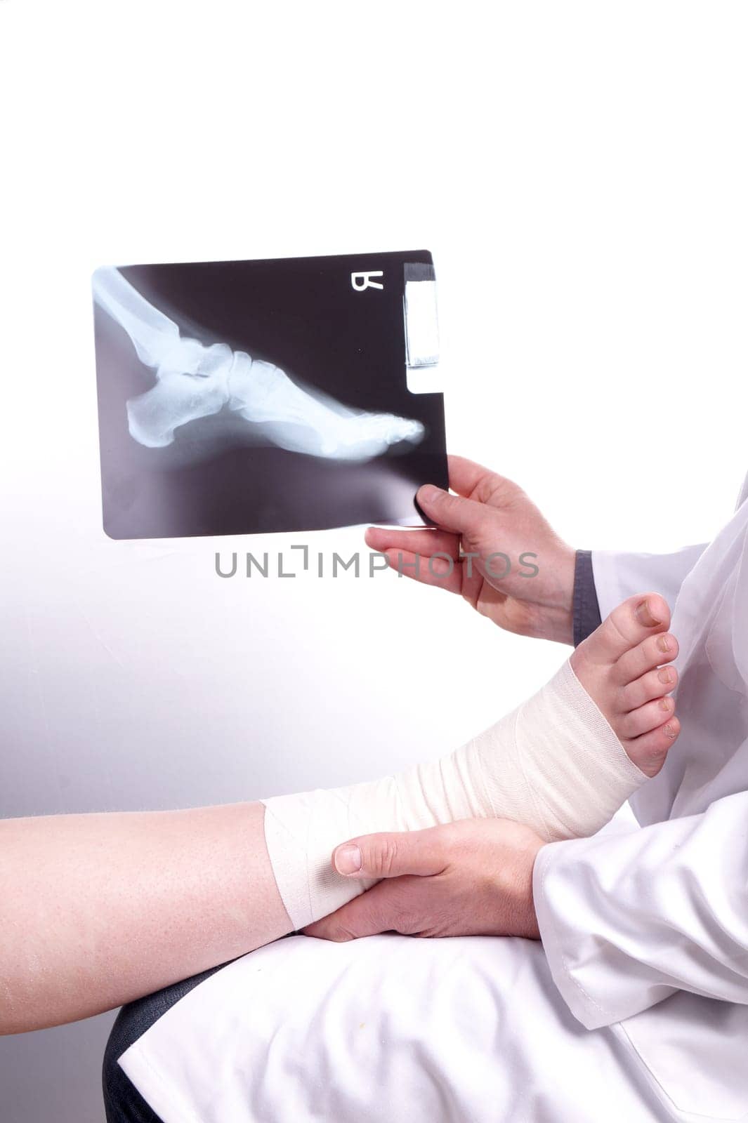 The doctor examines an X-ray picture , while the patient's sprained foot resting in his hand