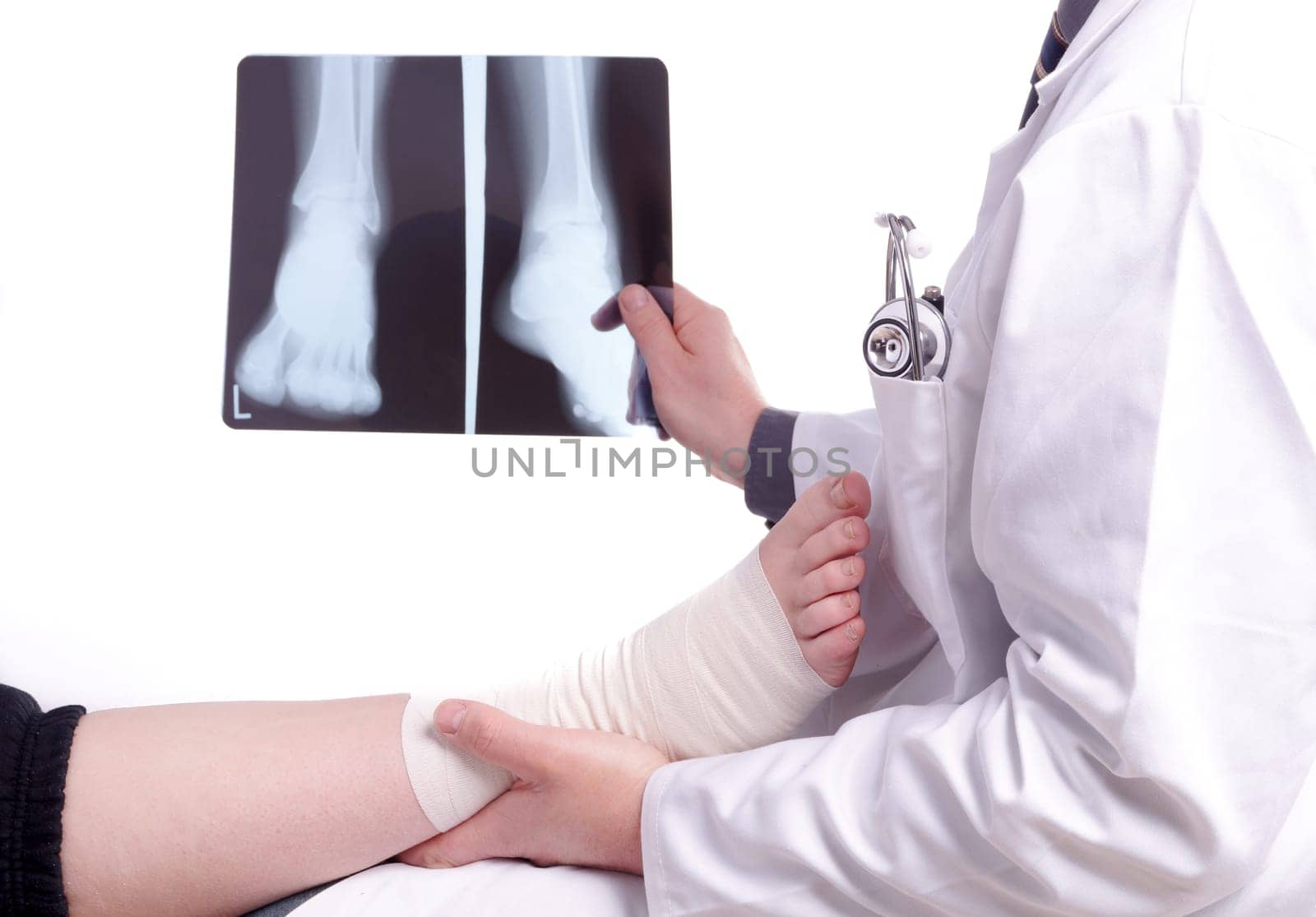 The doctor examines an X-ray picture , while the patient's sprained foot resting in his hand