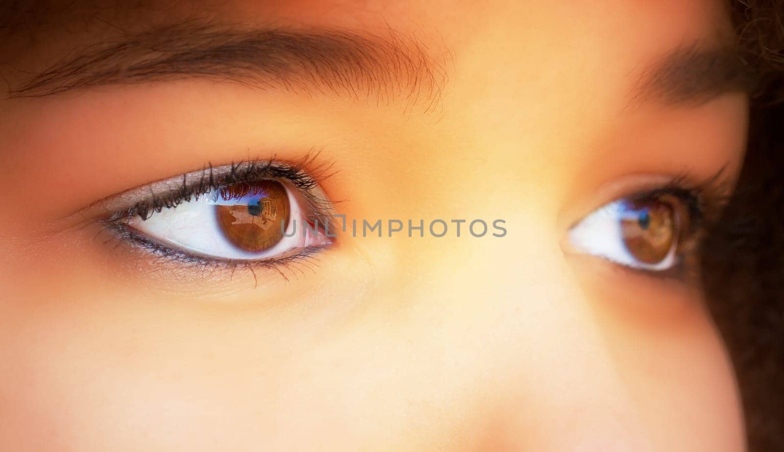 Sensitive eyes