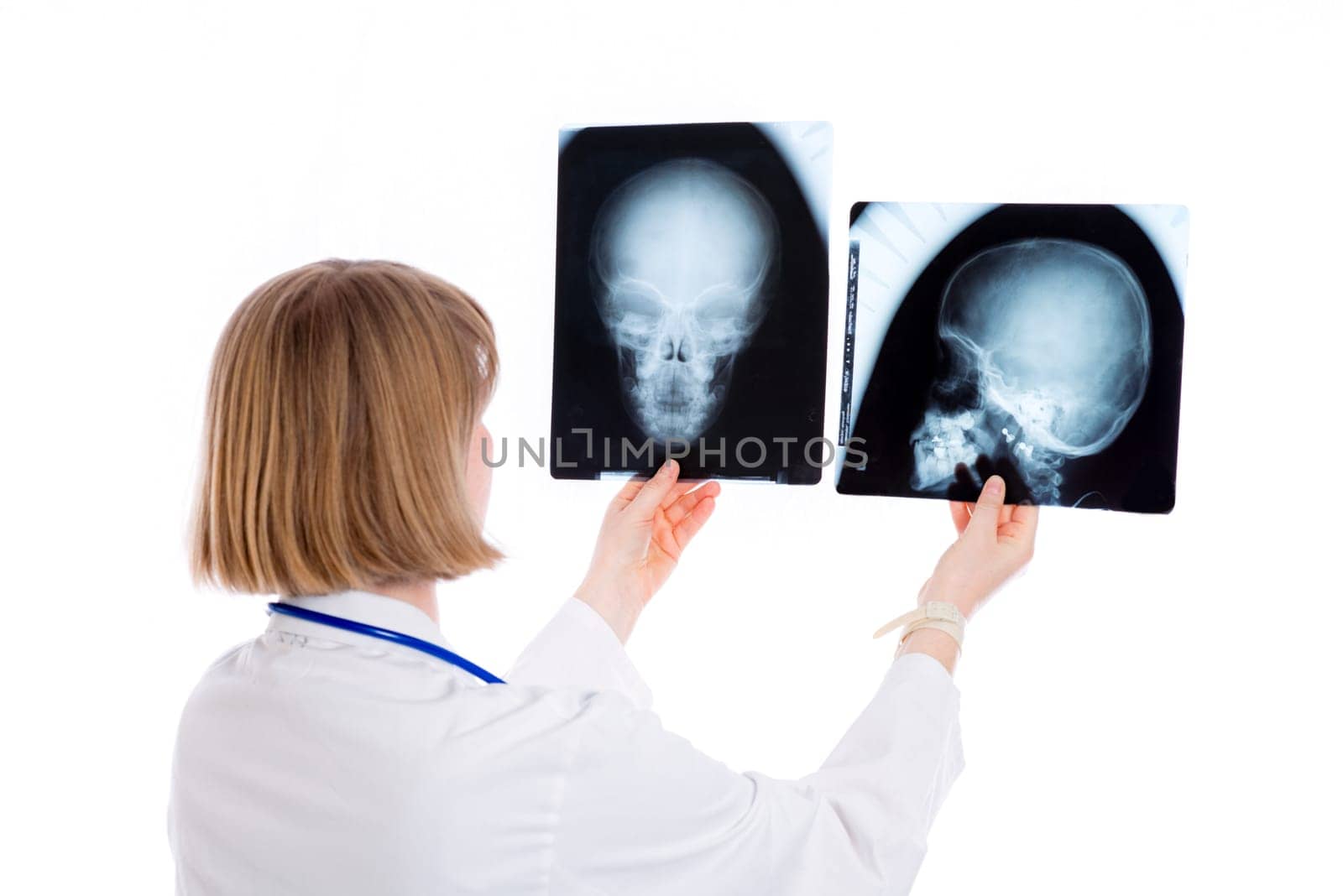 young female doctor with X-ray photograph in front of white background