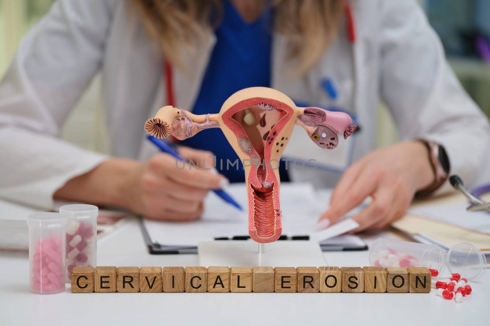 Dive into the comprehensive medical aspects surrounding c erosion utilizing this indepth educational model