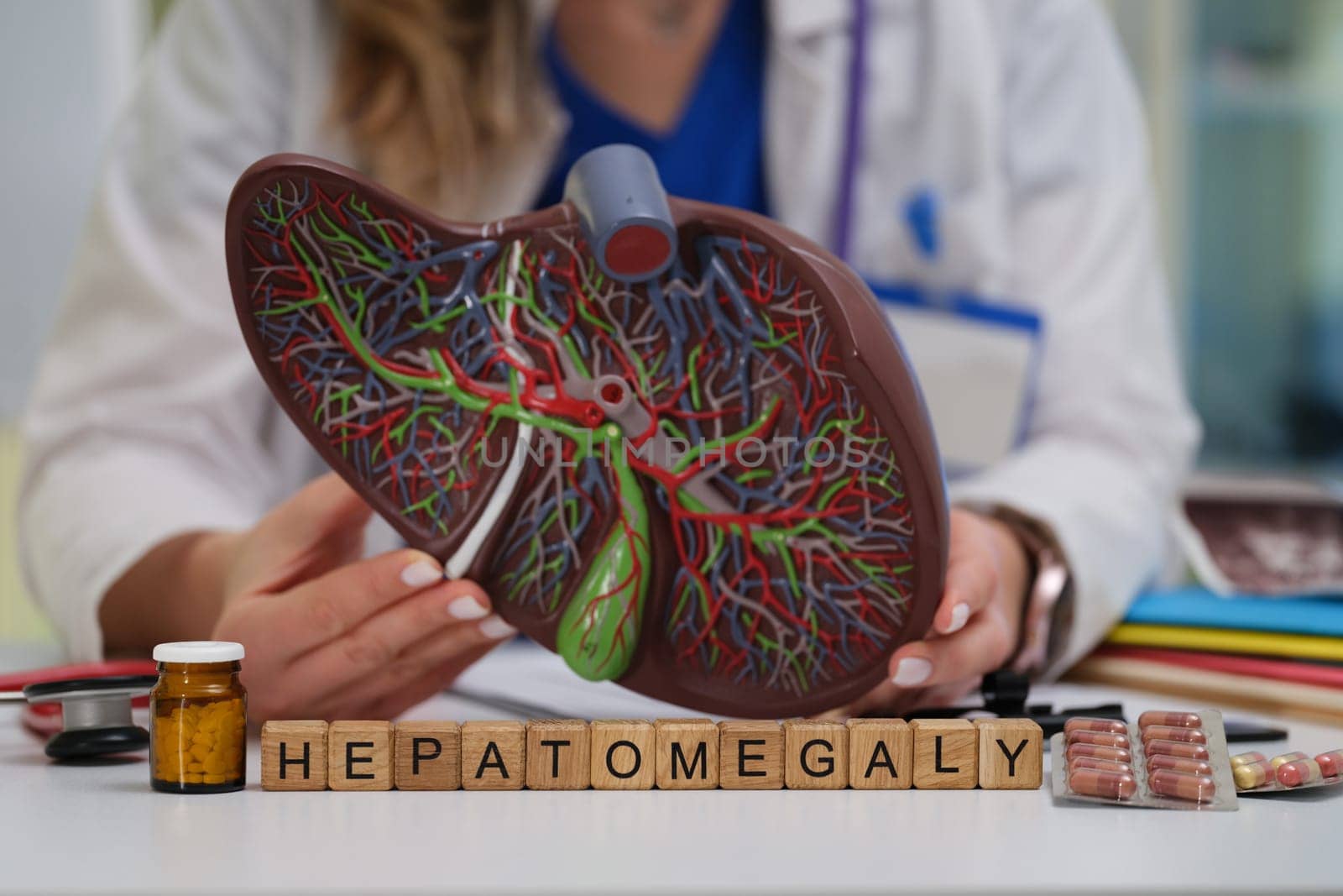 A visual representation illustrating hepatomegaly, emphasizing liver anatomy and essential medical context
