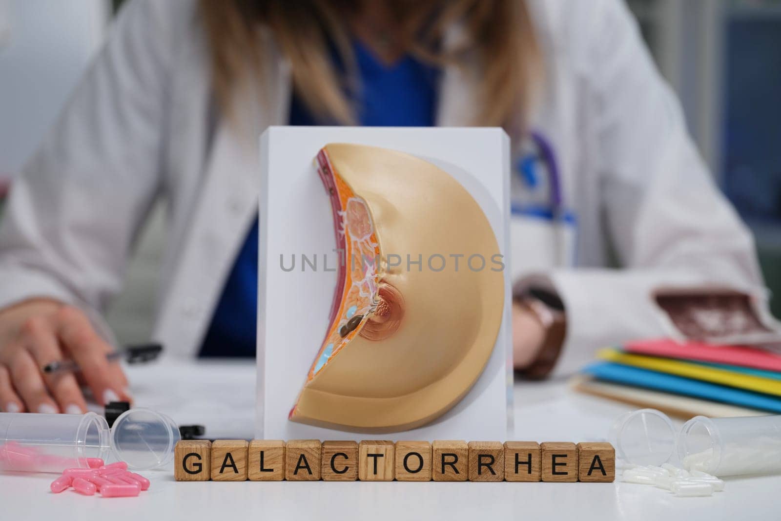 This is a comprehensive model that illustrates galactorrhea in a clinical setting, intended for educational purposes