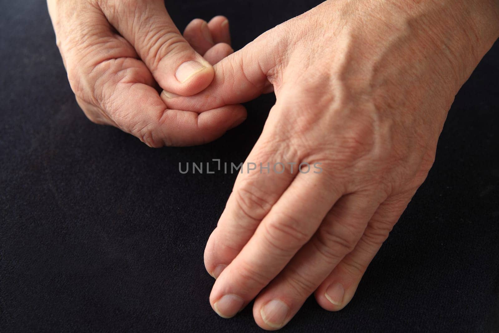 Older man has an aching thumb.