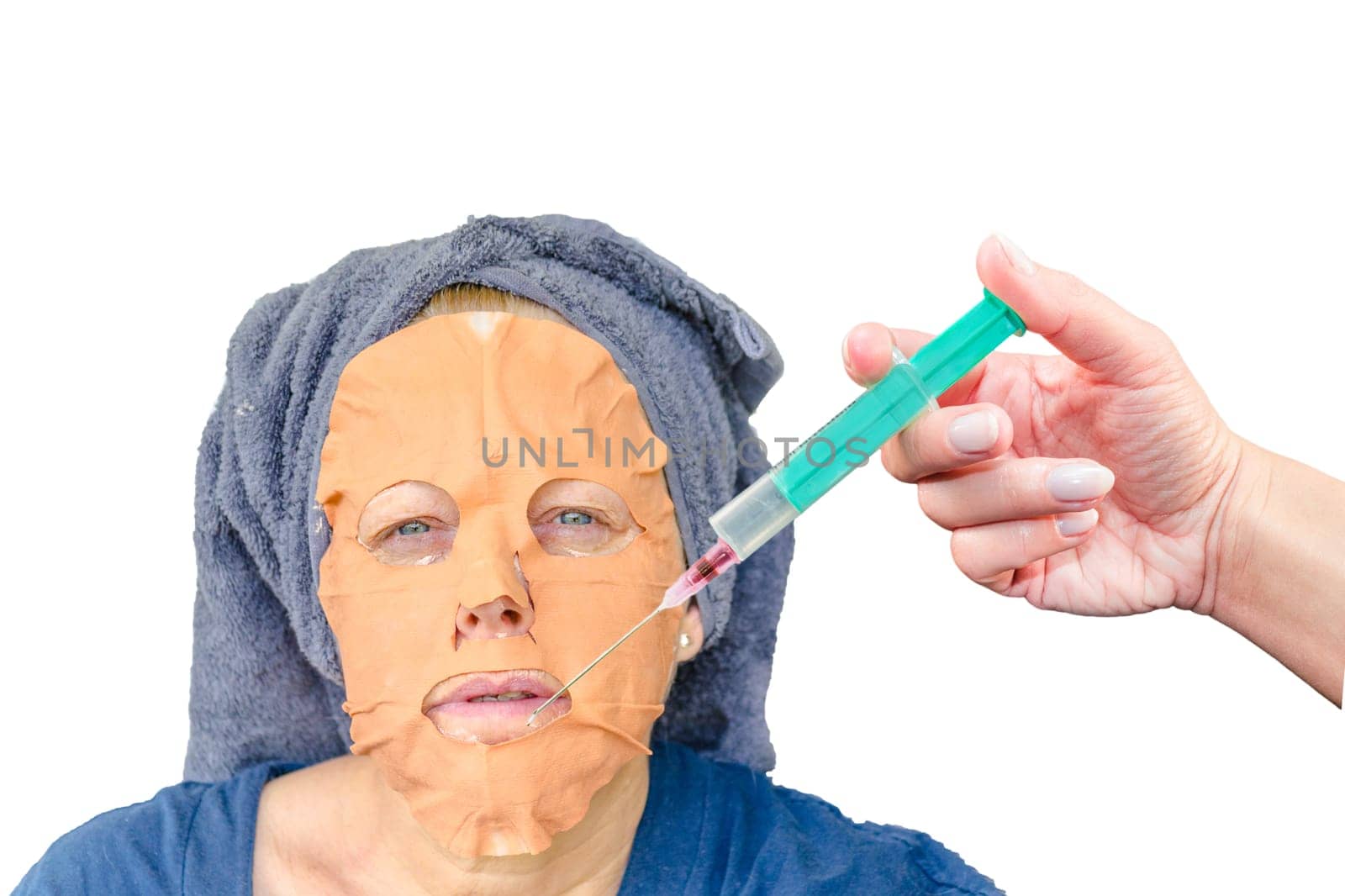Close-up portrait of a cosmetic face mask as well as a botulinum injection in the female face lip zone.