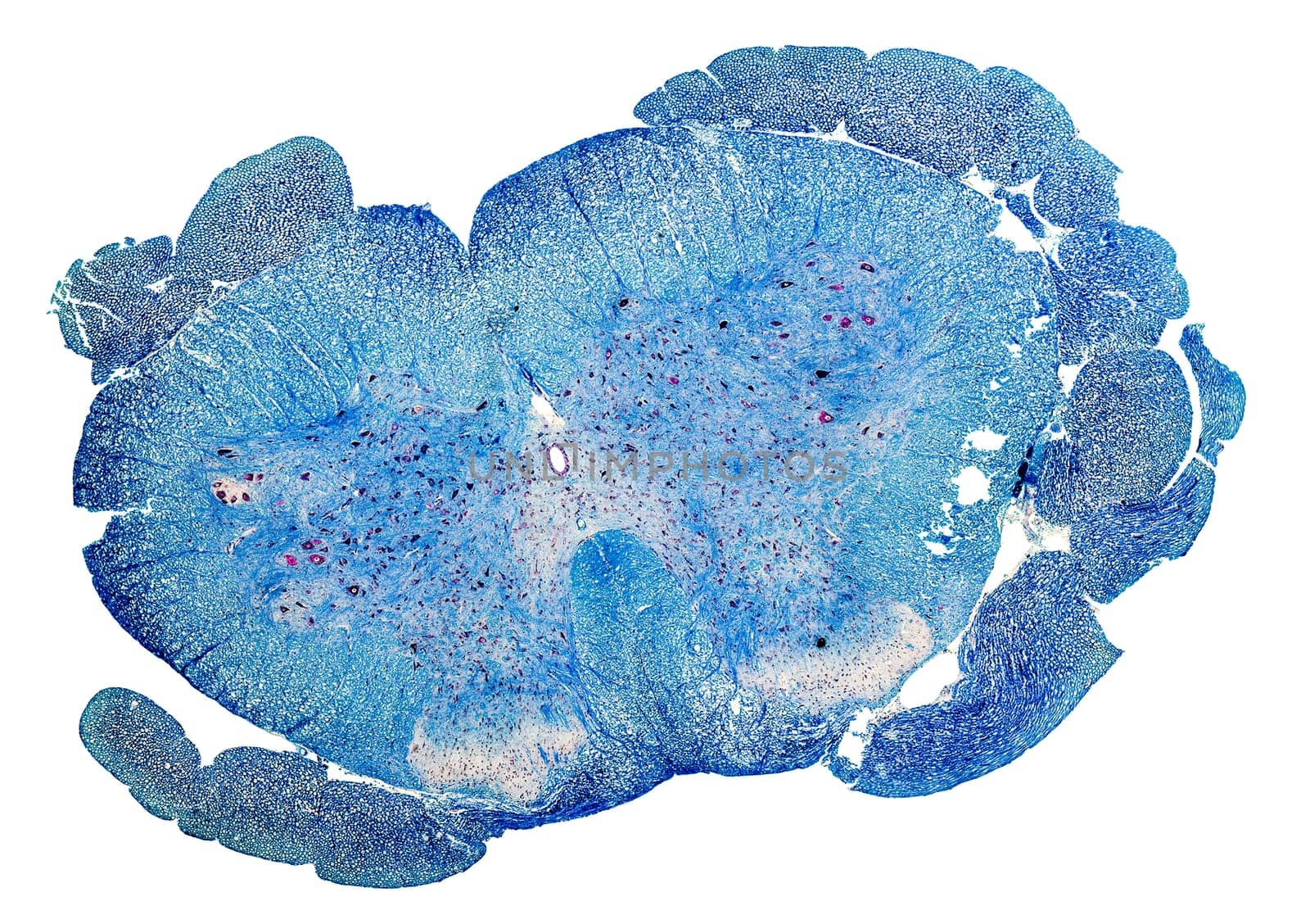 blue colored microscopic cross section of a spinal cord from a rat