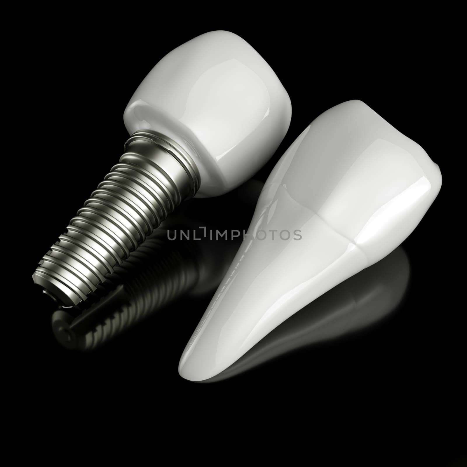 Tooth implant disassembled - (3d rendering)