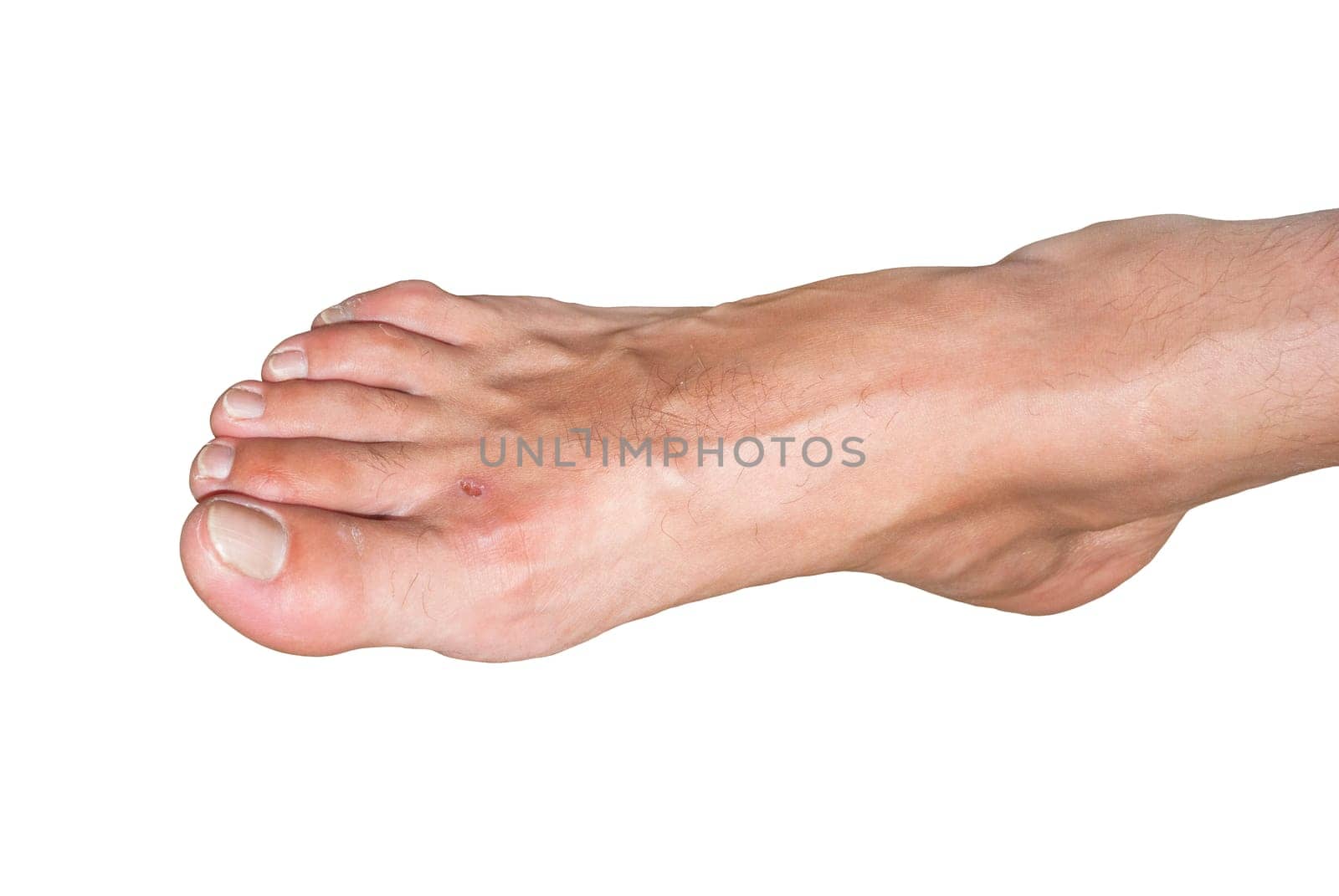 Male bare foot isolated on white