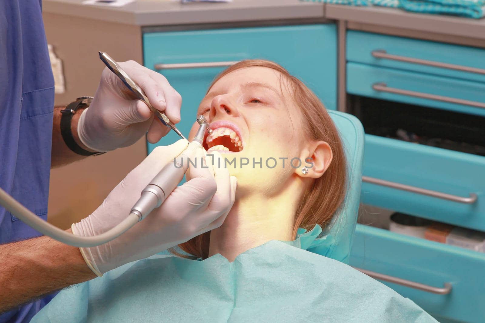 Dentist Polishing and Cleaning Teeth of Young Lady