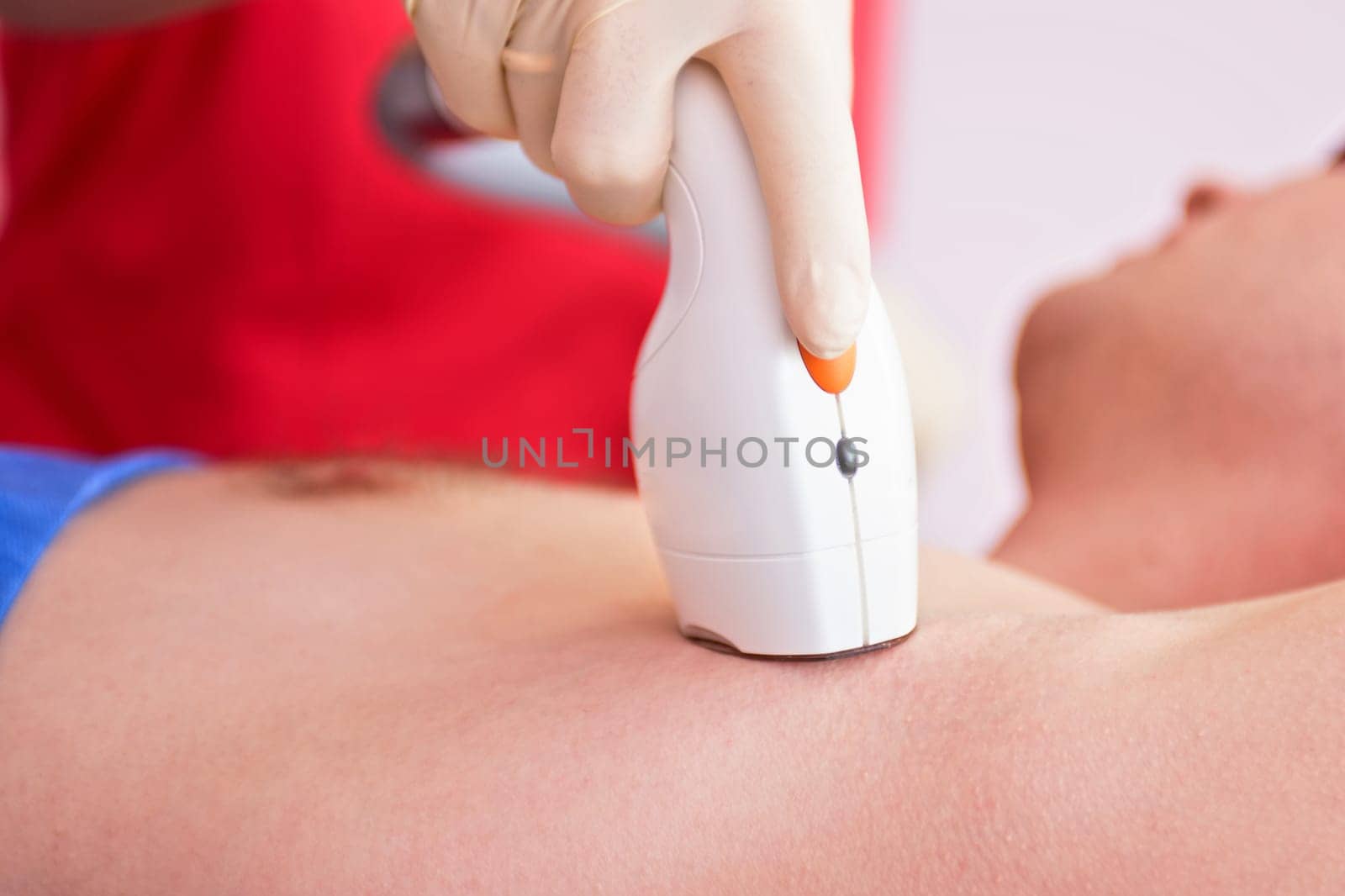 man receiving laser epilation at armpit on beauty center