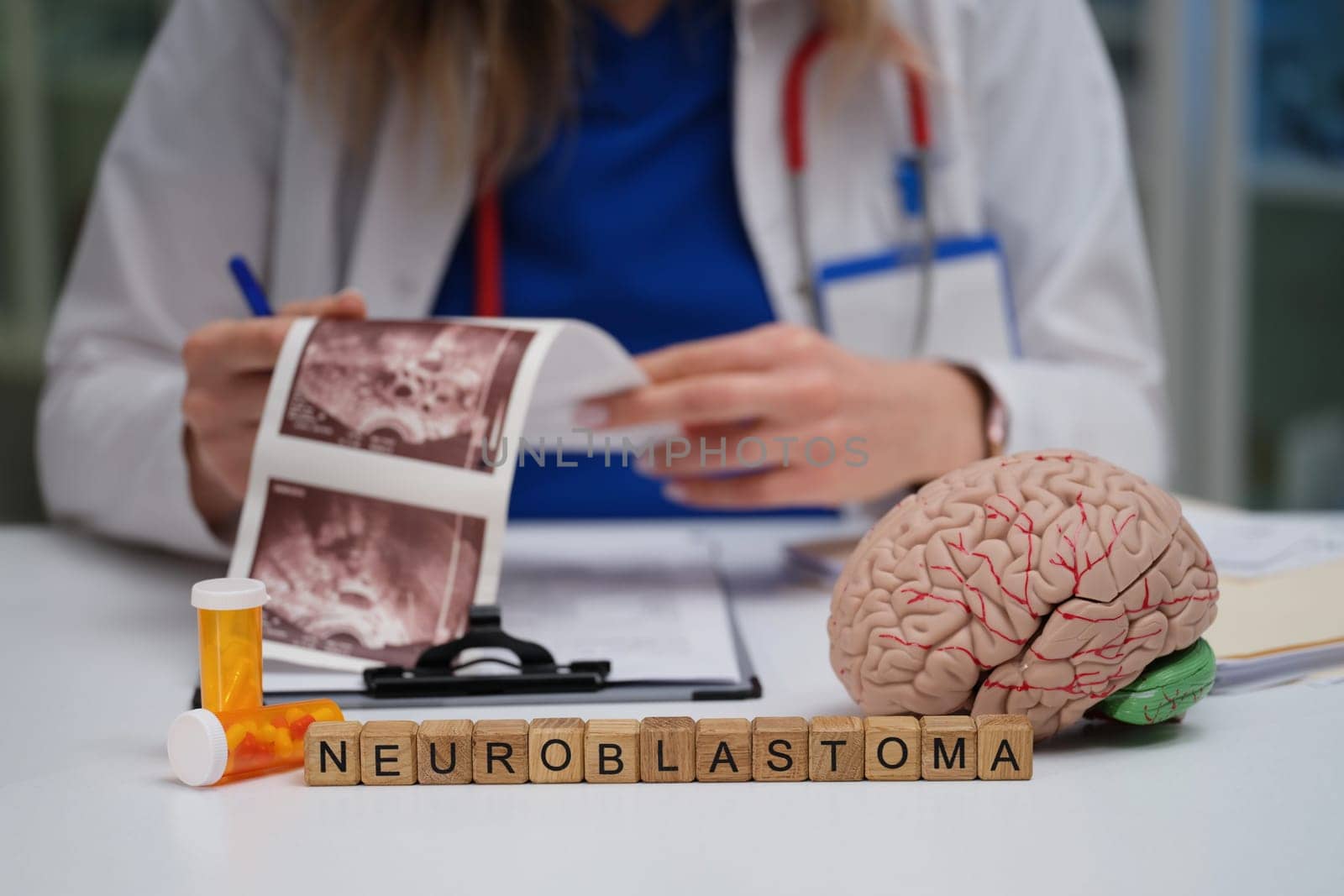 A medical professional studies neuroblastoma using a detailed brain model and various research materials