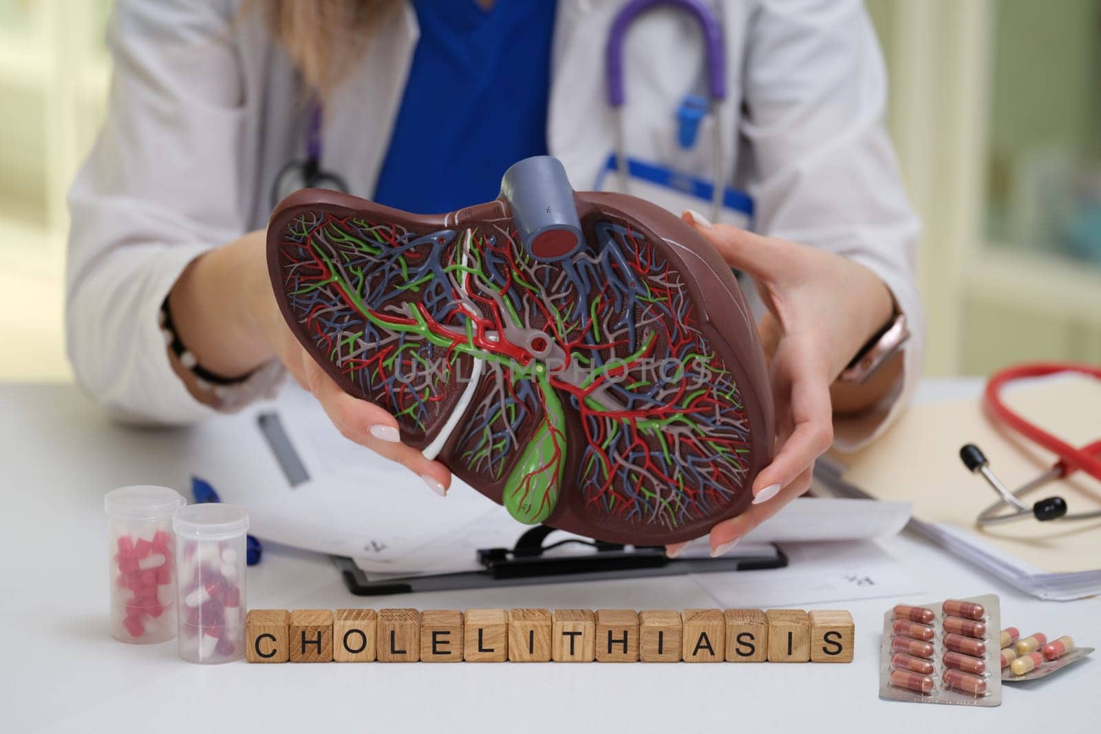 A skilled doctor demonstrates cholelithiasis using a detailed liver model with specific anatomical features