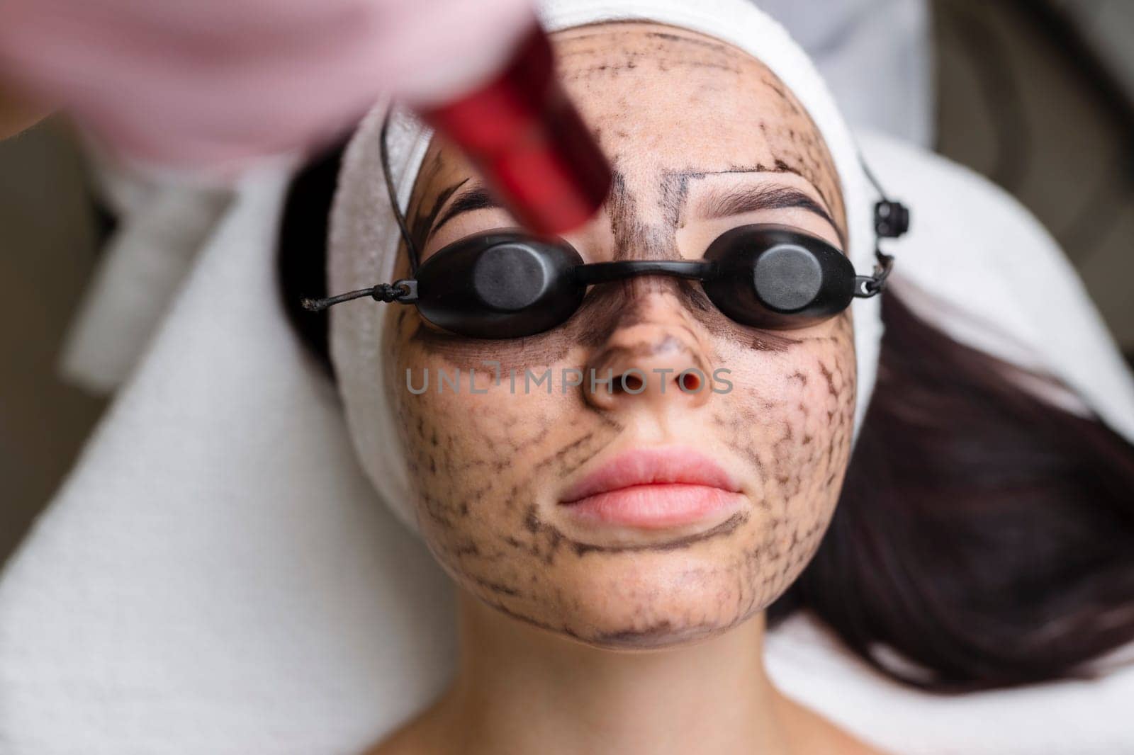 Beautician doing hardware carbon peeling to a young beautiful client in a headdress in goggles lying on a sofa in a beauty salon. Facial cleansing concept. Cosmetology services.