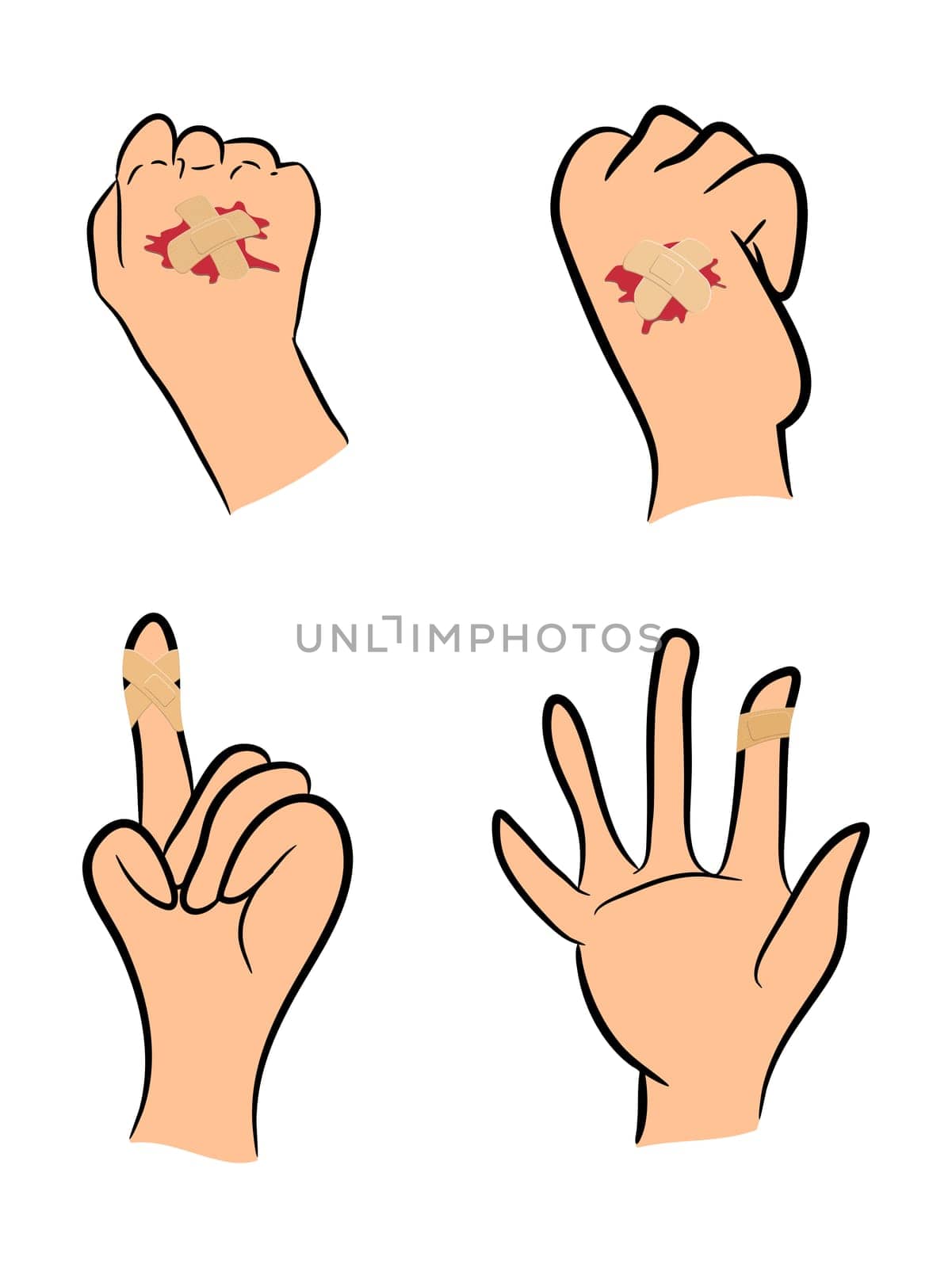 Set of Injured finger, hand wrapped in adhesive bandage, plaster  with red  blood puddle. Vector illustration isolated on white background.