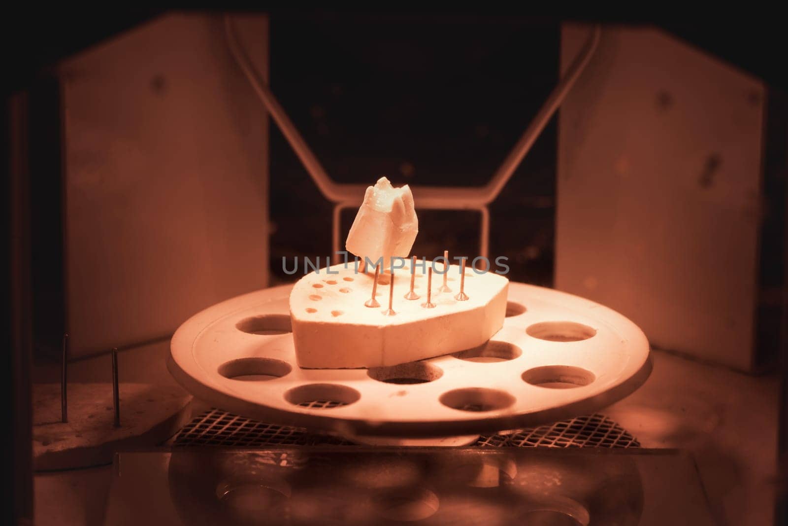 Dental prosthesis, artificial tooth. Photo of artificial teeth made in the dental laboratory.