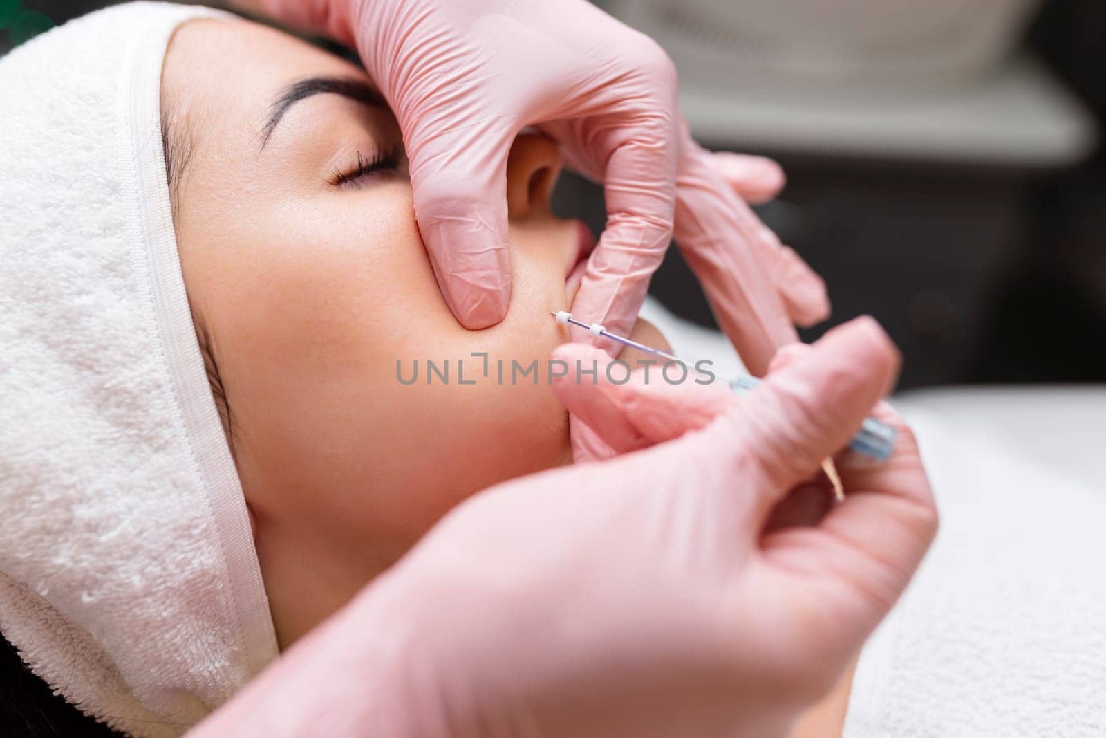 Face lifting PDO Suture operation. innovative technique of New thread lift, cosmetologist preparing to do procedure to female client, select the appropriate thread option.