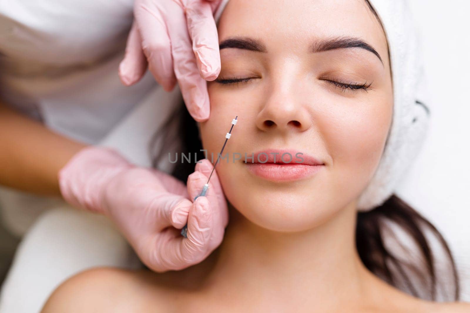 Face lifting PDO Suture operation. innovative technique of New thread lift, cosmetologist preparing to do procedure to female client, select the appropriate thread option.