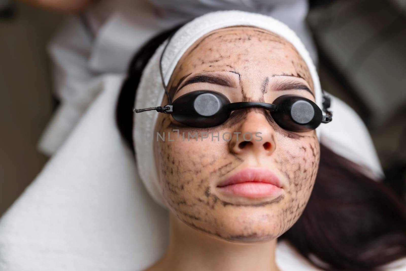 Beautician doing hardware carbon peeling to a young beautiful client in a headdress in goggles lying on a sofa in a beauty salon. Facial cleansing concept. Cosmetology services.