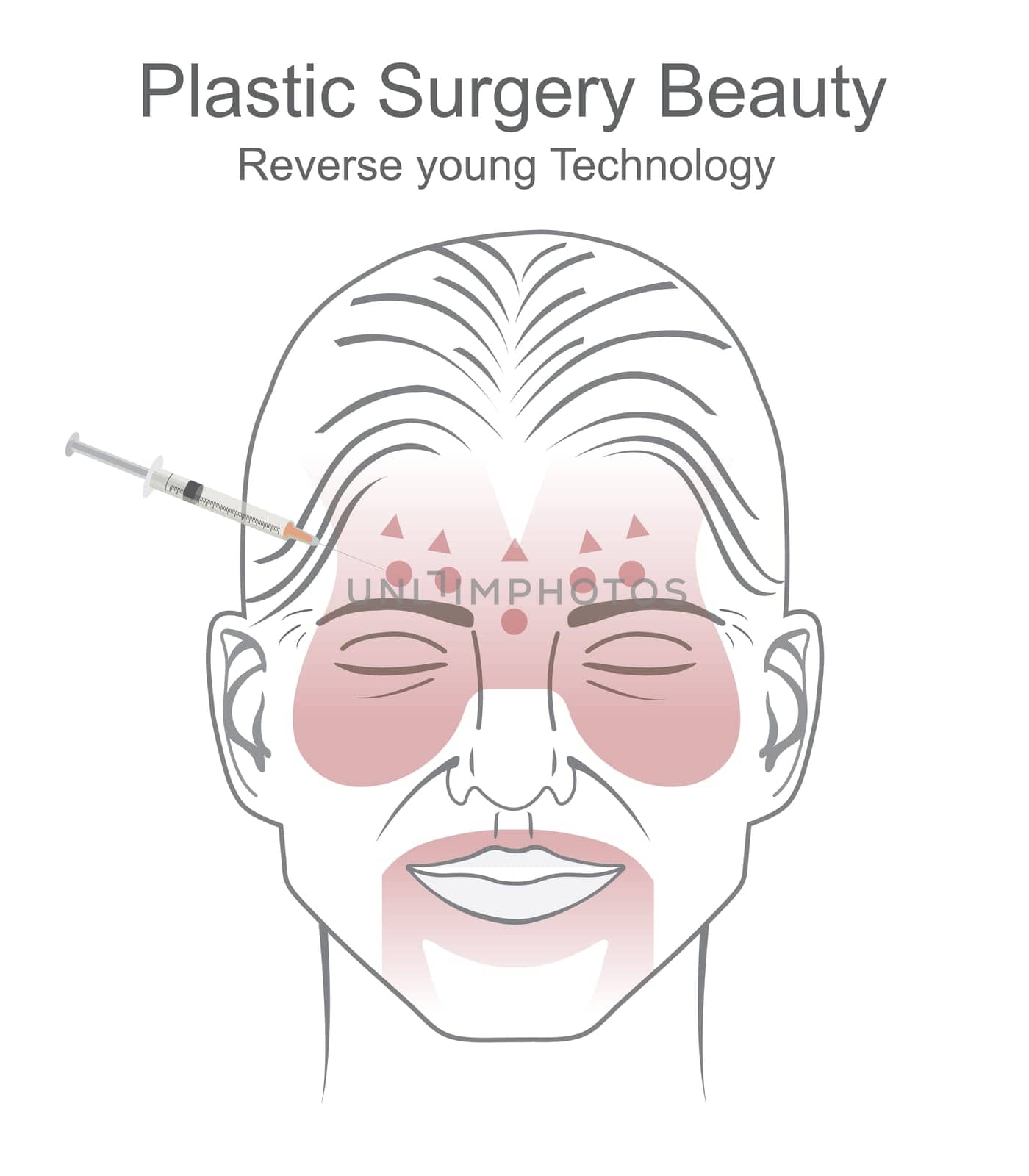 Plastic surgery is a surgical specialty involving the restoration, reconstruction, or alteration of the human body. It includes cosmetic or aesthetic surgery, reconstructive surgery, craniofacial surgery, hand surgery, microsurgery, and the treatment of burns.