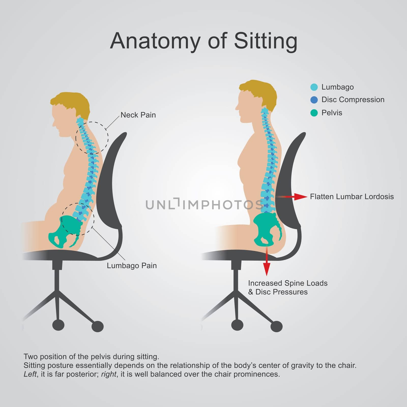 The lumbar region is sometimes referred to as the lower spine, or as an area of the back in its proximity.