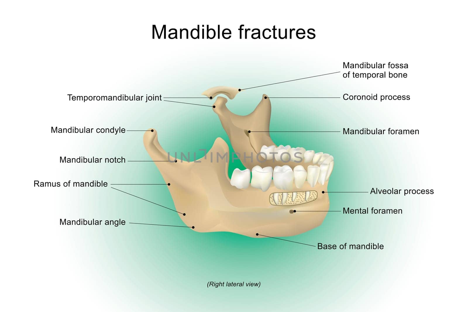 Mandible fractures is the largest, strongest and lowest bone in the face, Vector design, Arts, Illustration.