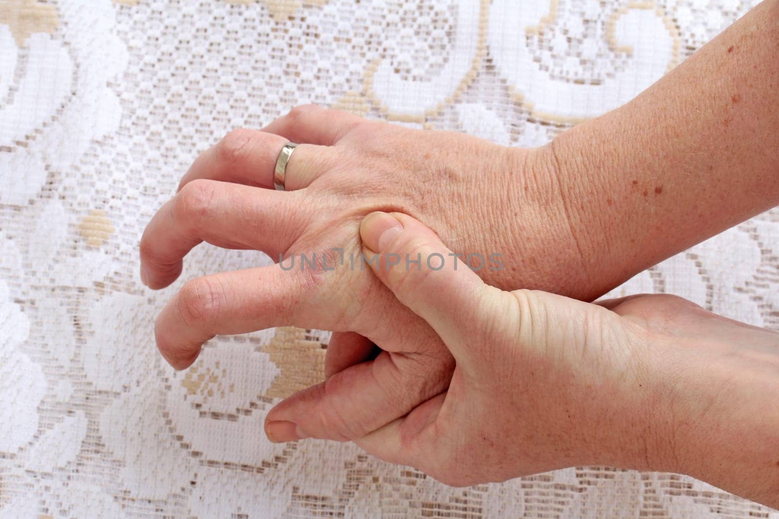 Strongly trembling hands in seniors. In a woman with Parkinson's,the hands tremble