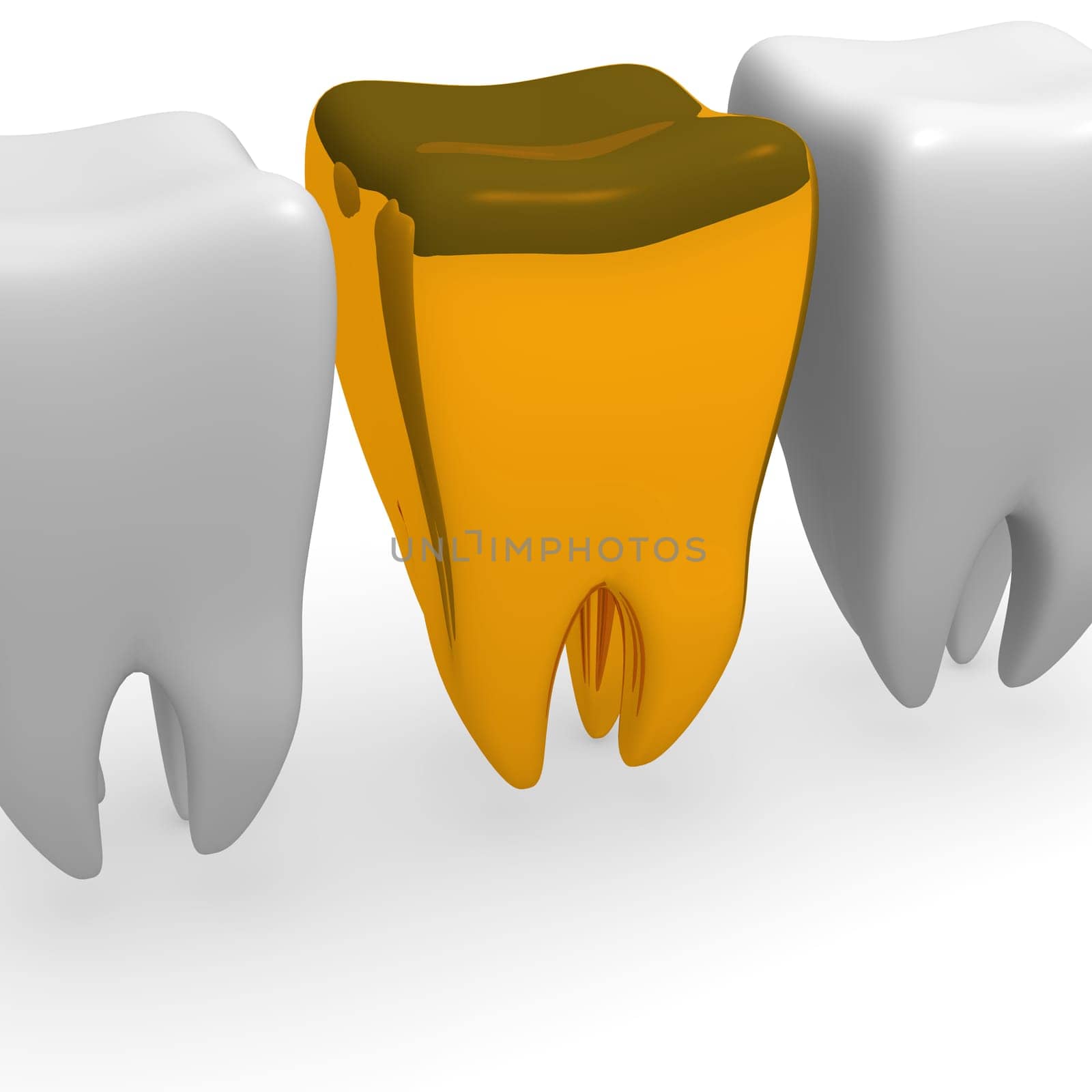 Golden tooth, medical 3d concept on a white background