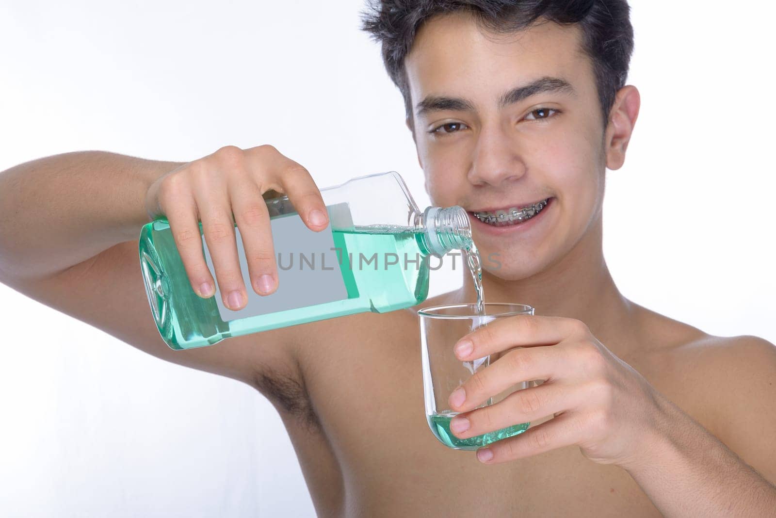 Cute teenager with white background, wearing braces on his teeth. Use mouthwash for oral hygiene.