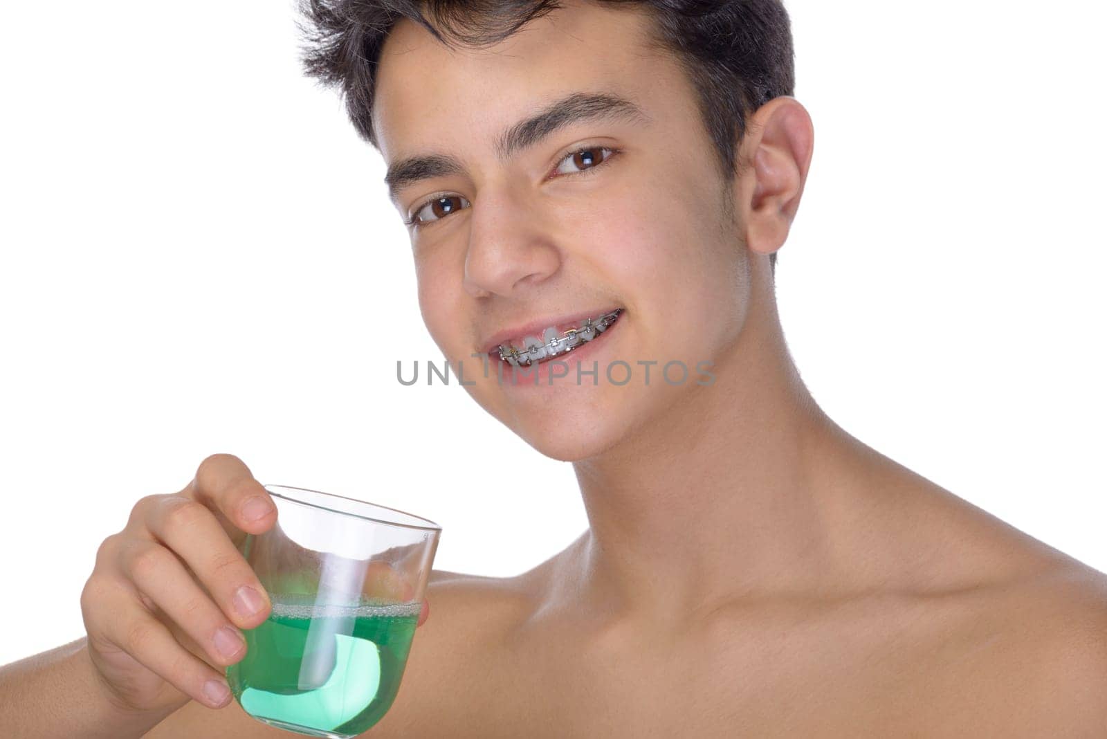 Cute teenager with white background, wearing braces on his teeth. Use mouthwash for oral hygiene.
