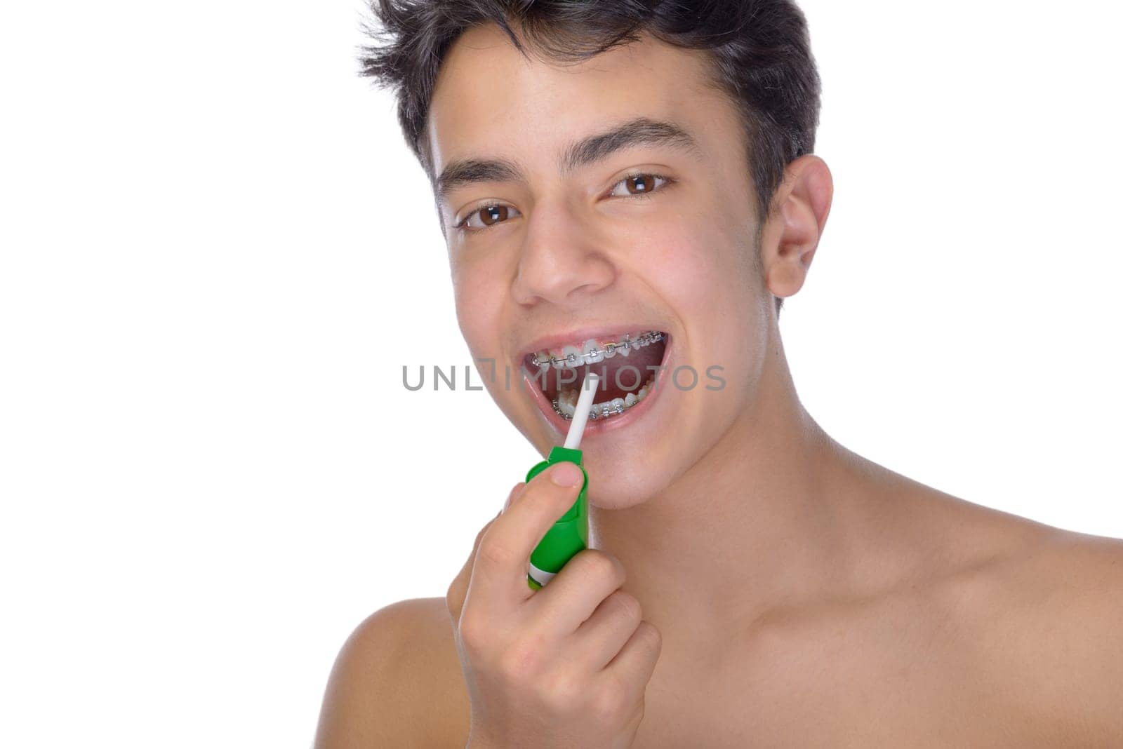 Cute teenager with white background, wearing braces on his teeth. Spray a disinfectant mouthwash in the throat.