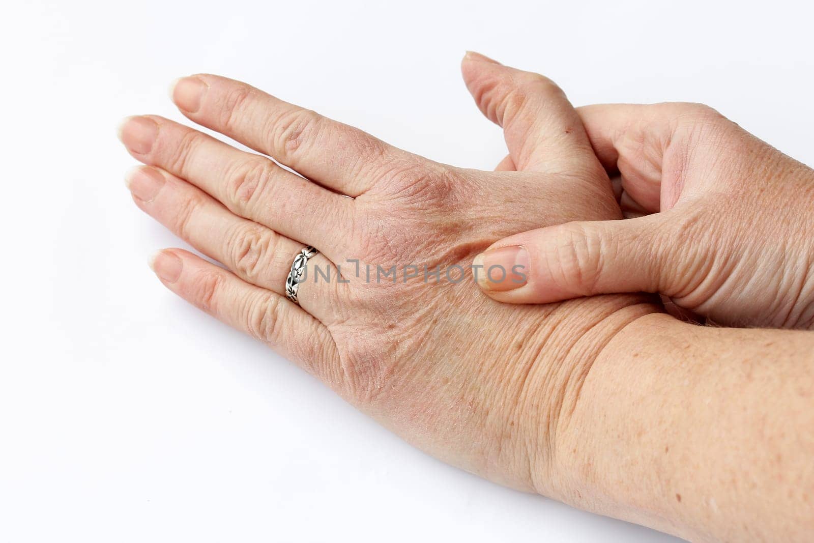 An elderly woman has pain in her hands. Senior citizen with pain in her hand