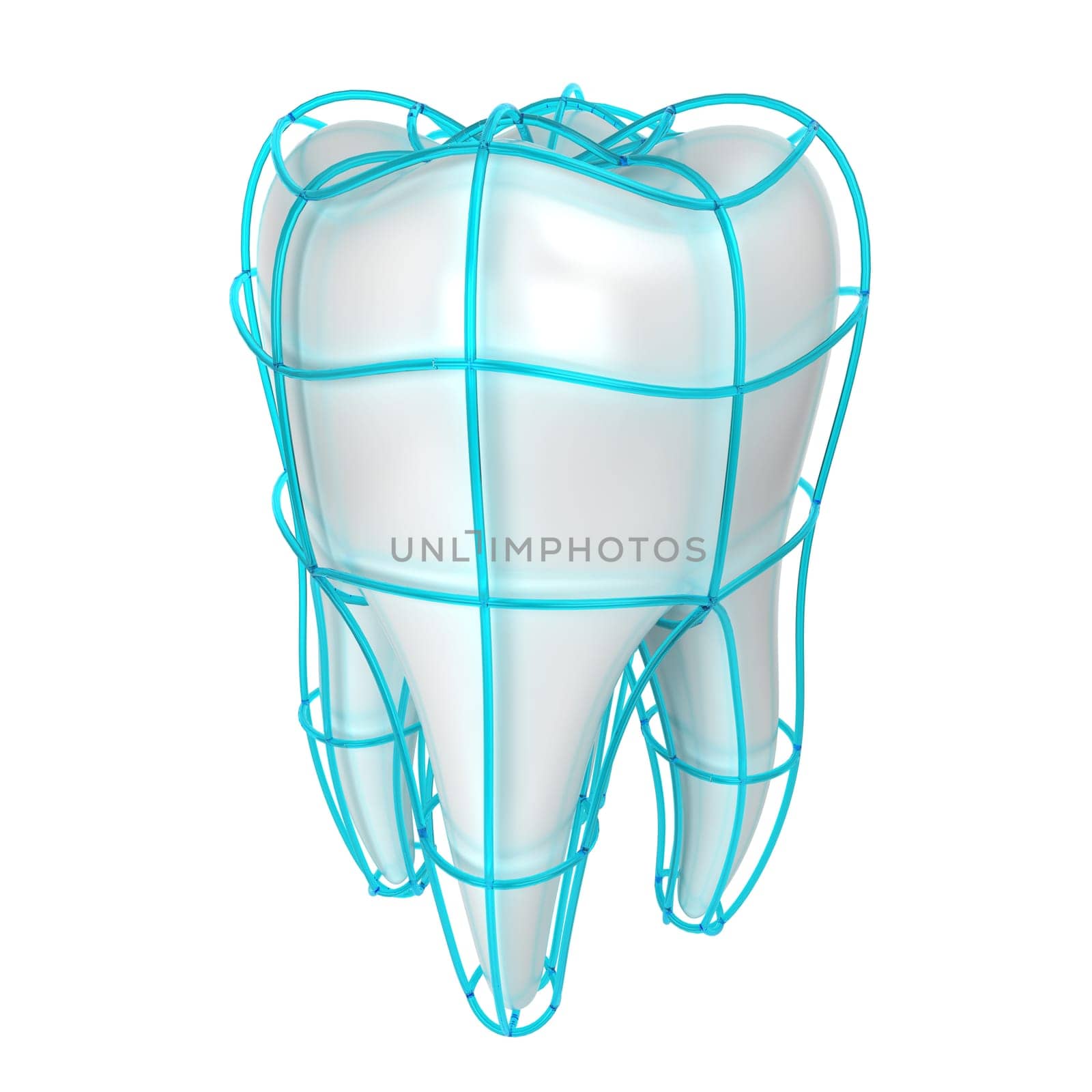 Tooth protection. 3d illustration isolated on white background