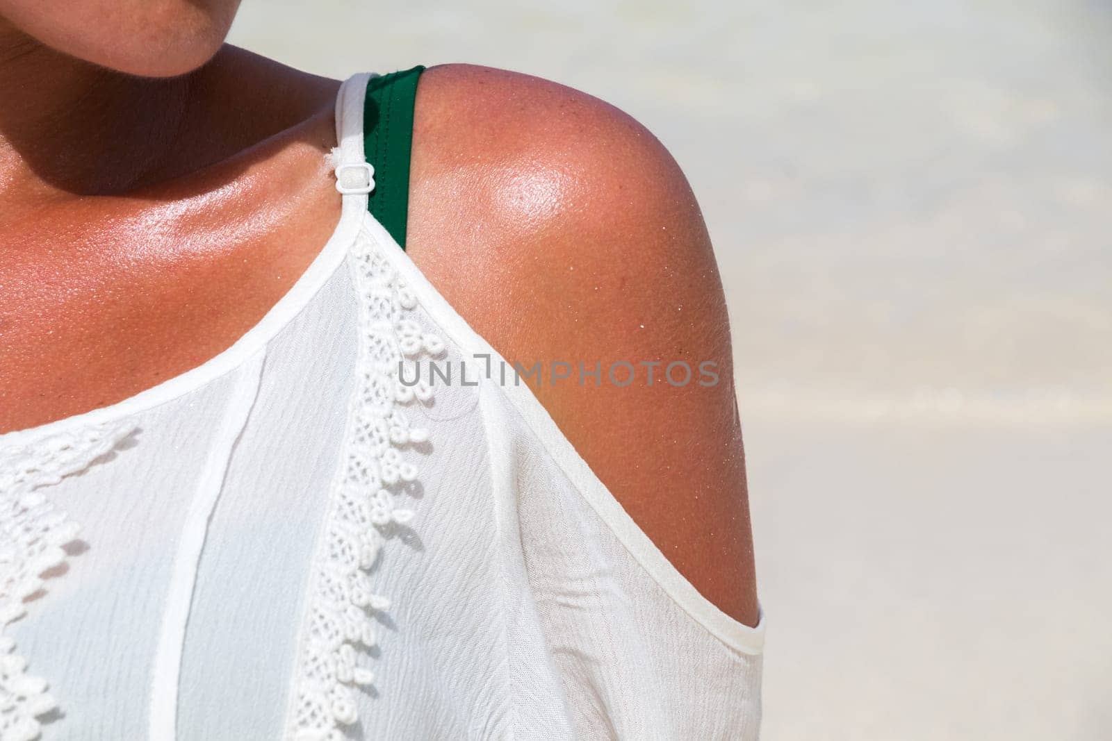 Woman shoulder under the sun at the dream beach